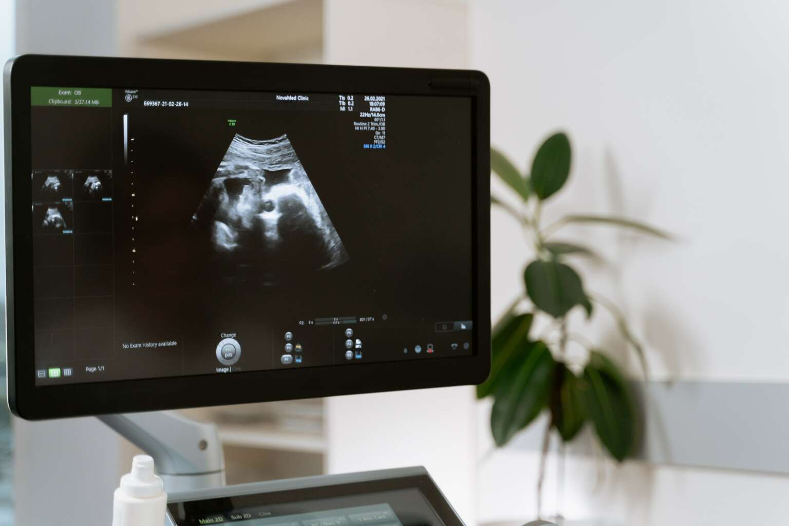 Sambandet mellan högt BMI och svårt att bli gravid: Vad du behöver veta